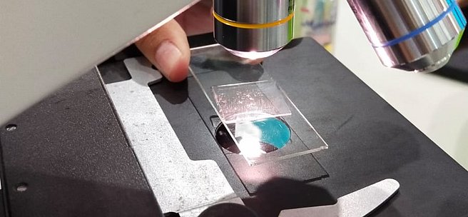 Sample Observation